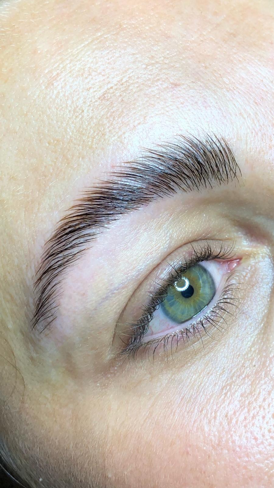 Brow Lifting Ergebnis